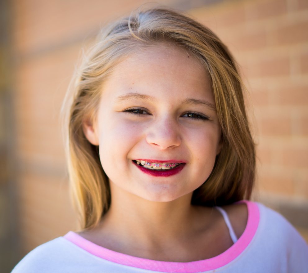 Young Smile Makers Orthodontics patient smiling with braces