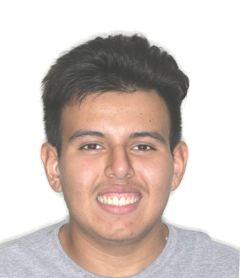 Case 04 patient portrait