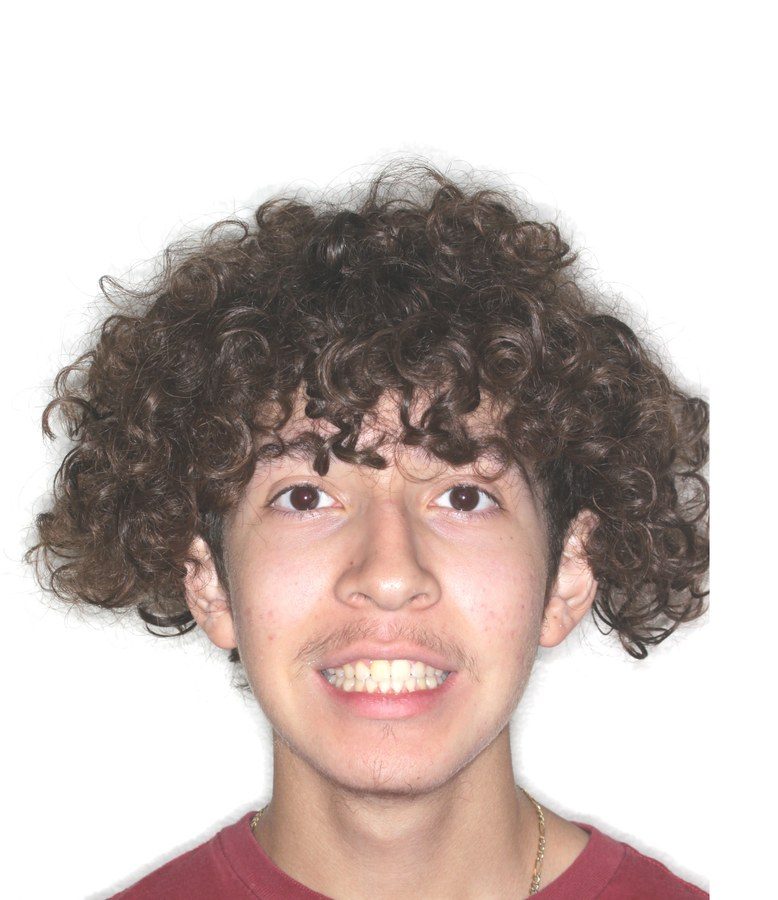 Case 11 patient portrait