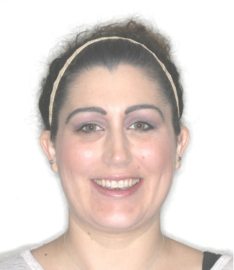 Case 13 patient portrait