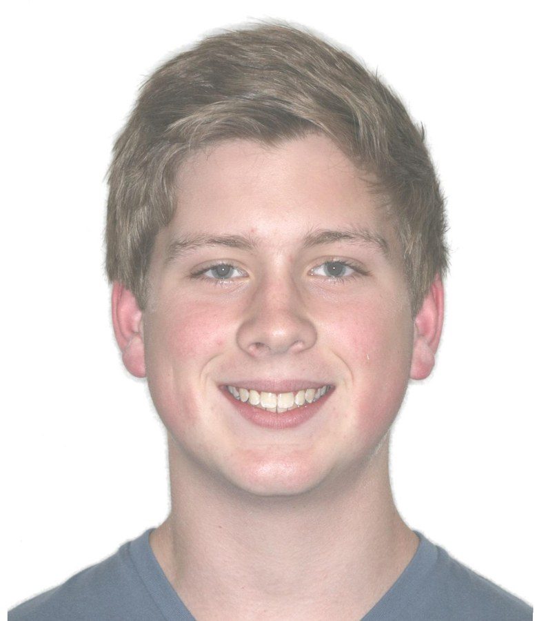 Case 18 patient portrait