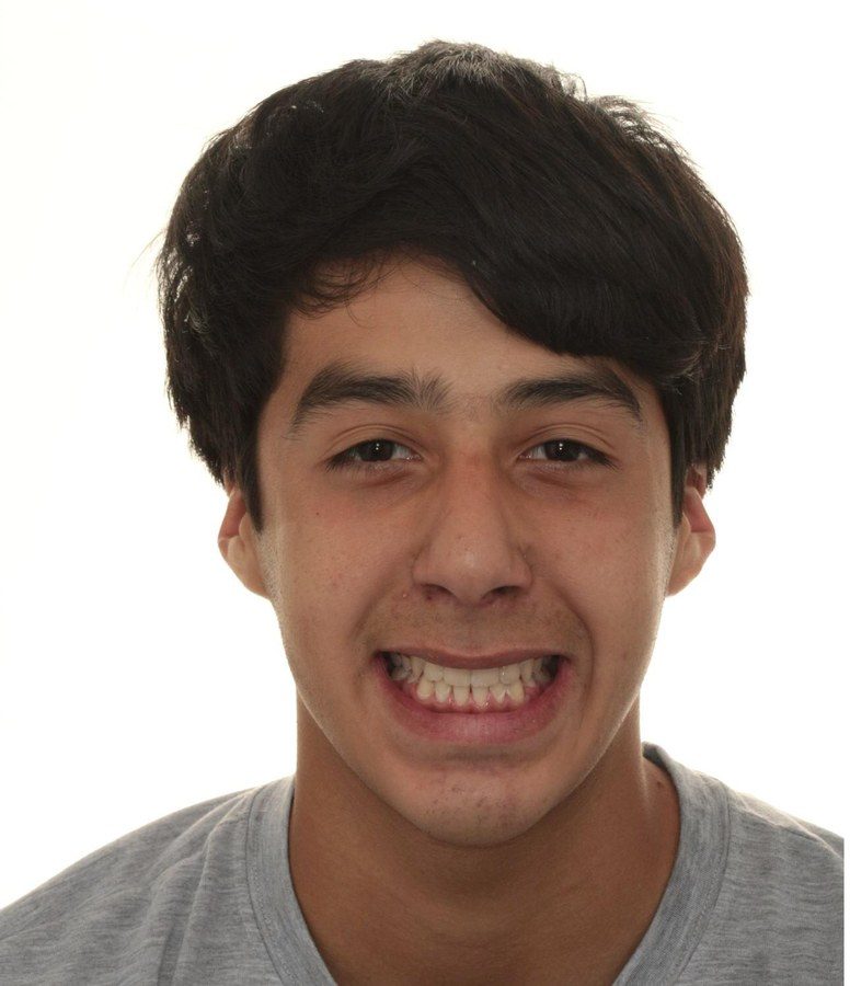 Case 24 patient portrait