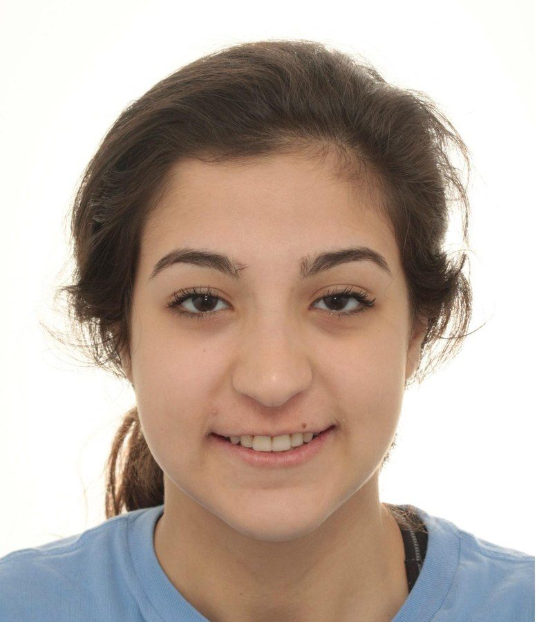 Case 25 patient portrait